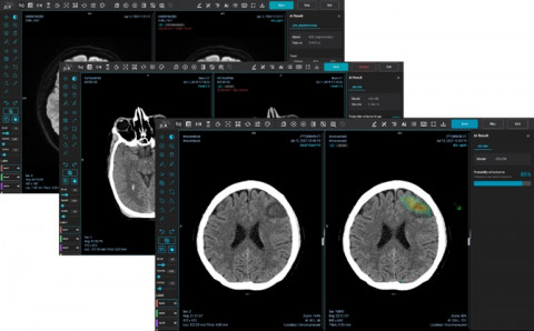 뇌졸중 토털솔루션 MEDIHUB STROKE
